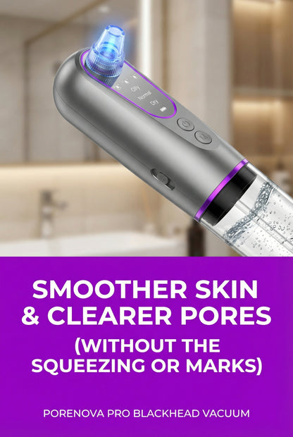 PoreNova Pro Blackhead Vacuum